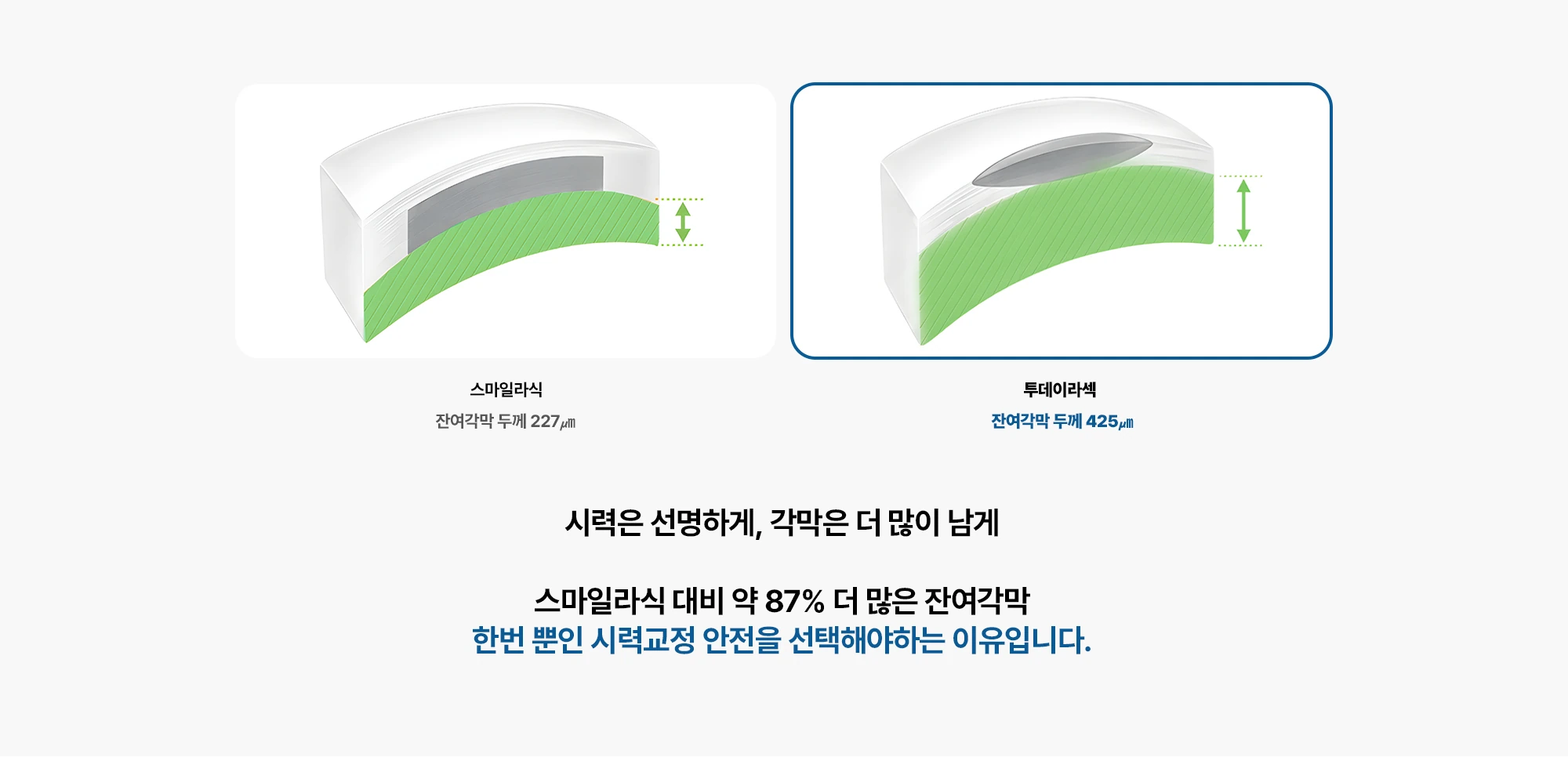 스마일라식 투데이라섹 잔여각막 두께 227㎛ 잔여각막 두께 425㎛ 시력은 선명하게, 각막은 더 많이 남게 스마일라식 대비 약 87% 더 많은 잔여각막 한번 뿐인 시력교정 안전을 선택해야하는 이유입니다.